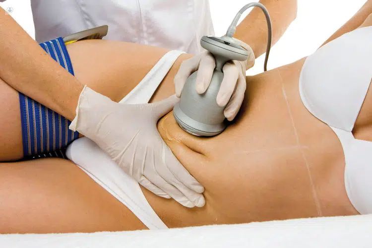 Tratamiento de Cavitación Estética para eliminación de grasa localizada